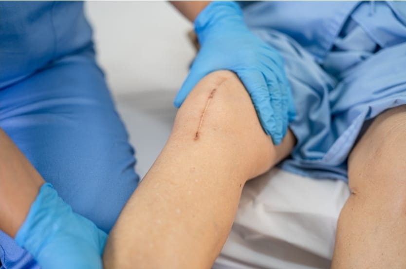 recuperare postoperatorie și kinetoterapie în București Sector 5
